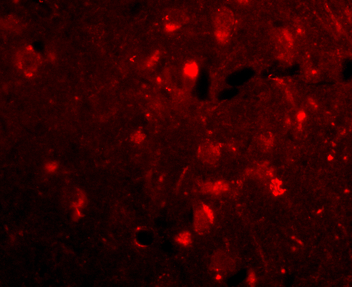 a11967 slitrk2 primary antibodies if testing 3