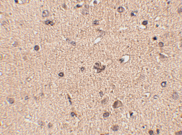 a11967 slitrk2 primary antibodies ihc testing 2