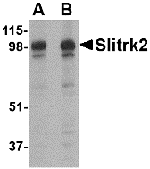 a11967 slitrk2 primary antibodies wb testing 1
