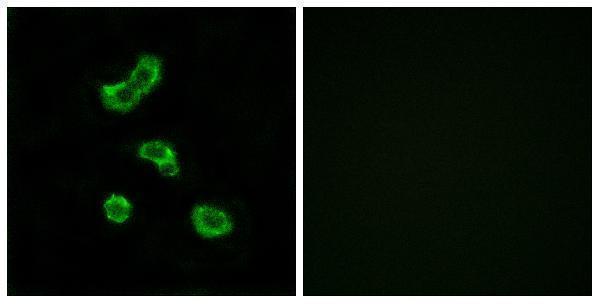 a11974 1 ca5b primary antibodies if testing 1