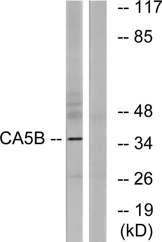 a11974 1 ca5b primary antibodies wb testing 2