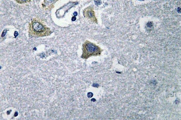 a11974 ca5b primary antiboties ihc testing 2
