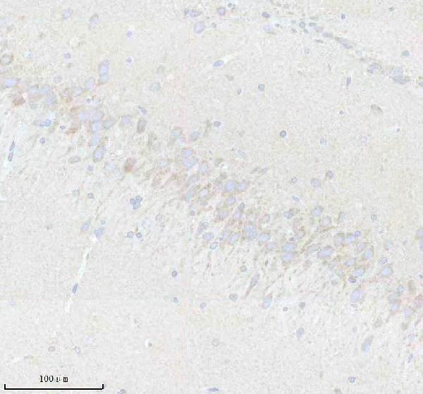 a11977 1 slc24a3 primary antibodies ihc testing 1