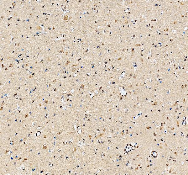 a11979 1 ints1 primary antibodies ihc testing 1