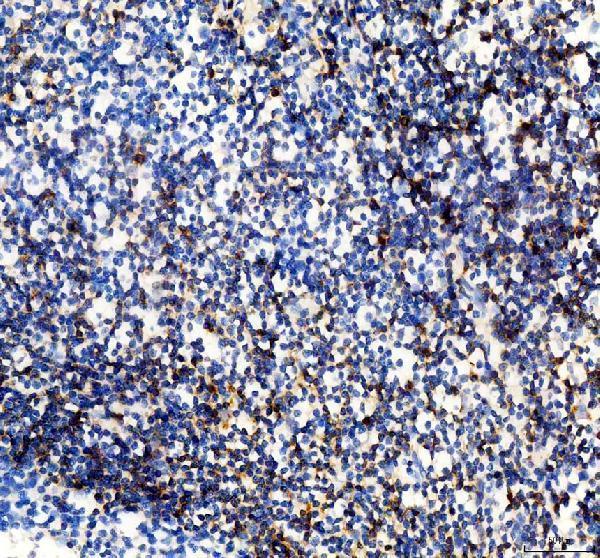 IHC analysis of PLAC8 using anti-PLAC8 antibody (A11984)