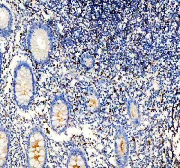 IHC analysis of PLAC8 using anti-PLAC8 antibody (A11984)