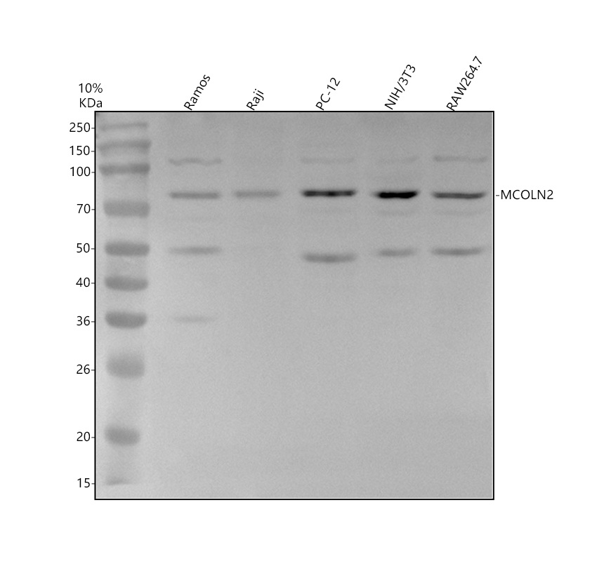 Western blot analysis of MCOLN2 using anti-MCOLN2 antibody (A11985)