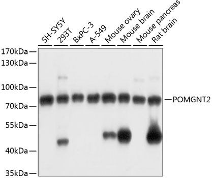a11987 pomgnt2 primary antiboties wb testing 1
