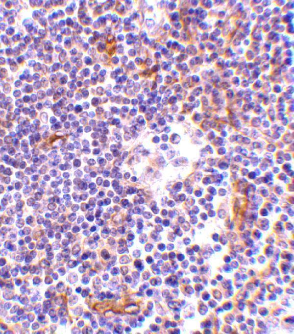a11990 nkiras1 primary antibodies ihc testing 2