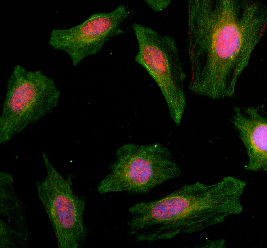 a11993 2 mtmr7 primary antibodies if testing 1