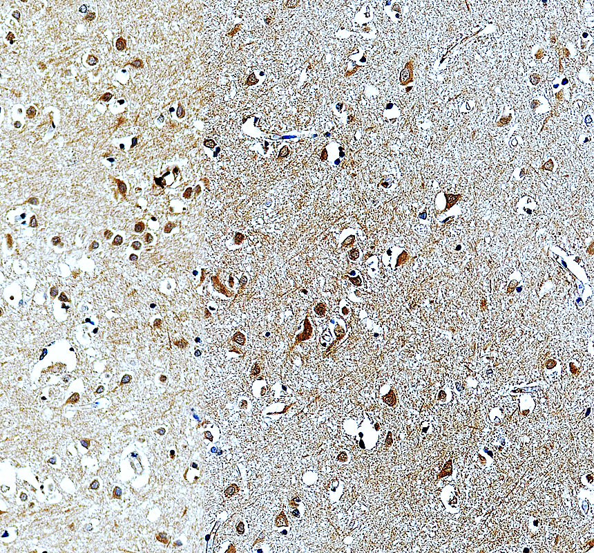 IHC analysis of MTMR7 using anti-MTMR7 antibody (A11993-2)