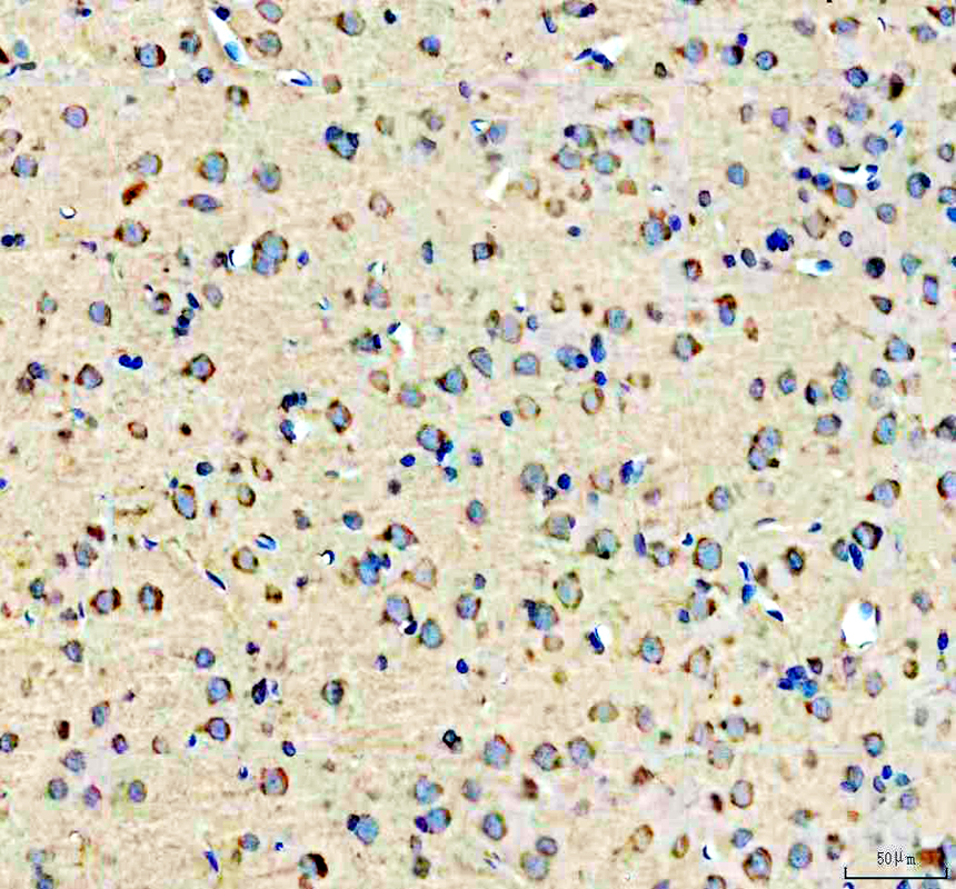 IHC analysis of MTMR7 using anti-MTMR7 antibody (A11993-2)