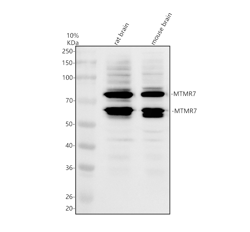 Western blot analysis of MTMR7 using anti-MTMR7 antibody (A11993-2)