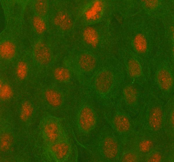 Figure 2. IF analysis of PBX4 using anti-PBX4 antibody (A11995-1) and anti-Beta Tubulin antibody (M01857-3). PBX4 was detected in immunocytochemical section of A431 cell. Enzyme antigen retrieval was performed using IHC enzyme antigen retrieval reagent (AR0022) for 15 mins. The cells were blocked with 10% goat serum. And then incubated with 5 microg/mL rabbit anti-PBX4 Antibody (A11995-1) and mouse anti-Beta Tubulin antibody (M01857-3) overnight at 4°C. Cy3 Conjugated Goat Anti-Rabbit IgG (BA1032) and FITC Conjugated Goat Anti-Mouse IgG (BA1101) were used as secondary antibody at 1:500 dilution and incubated for 30 minutes at 37°C. Visualize using a fluorescence microscope and filter sets appropriate for the label used.
