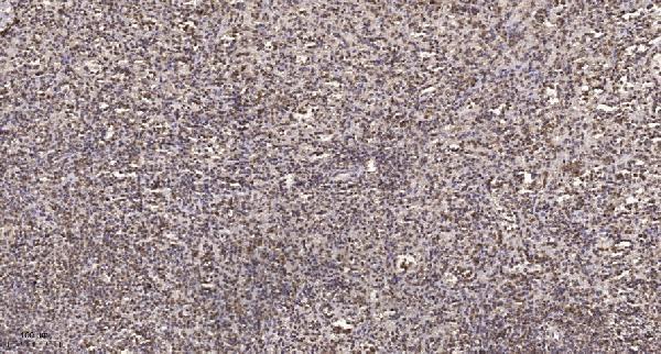 a12003 gtf3c3 primary antibodies ihc testing 1