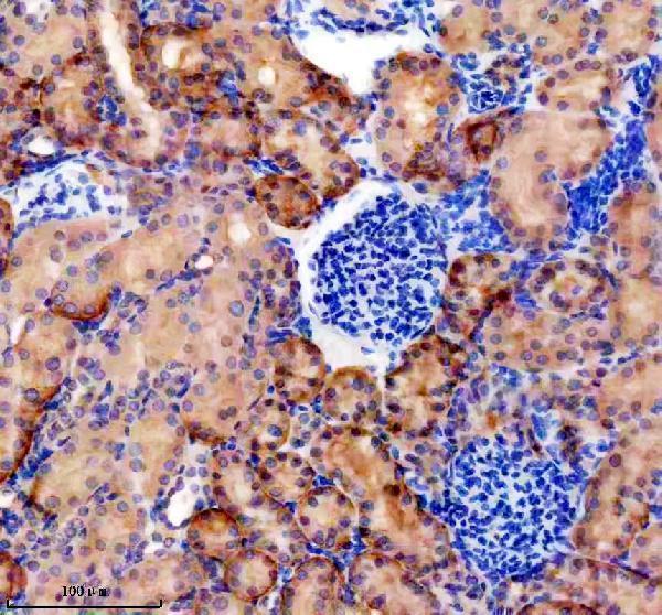 a12006 slc51b primary antibodies ihc testing 1