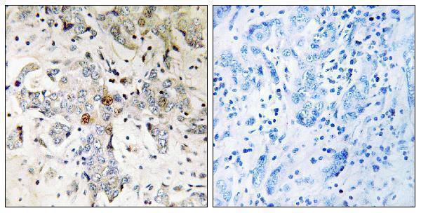a12008 zcchc17 primary antibodies ihc testing 1