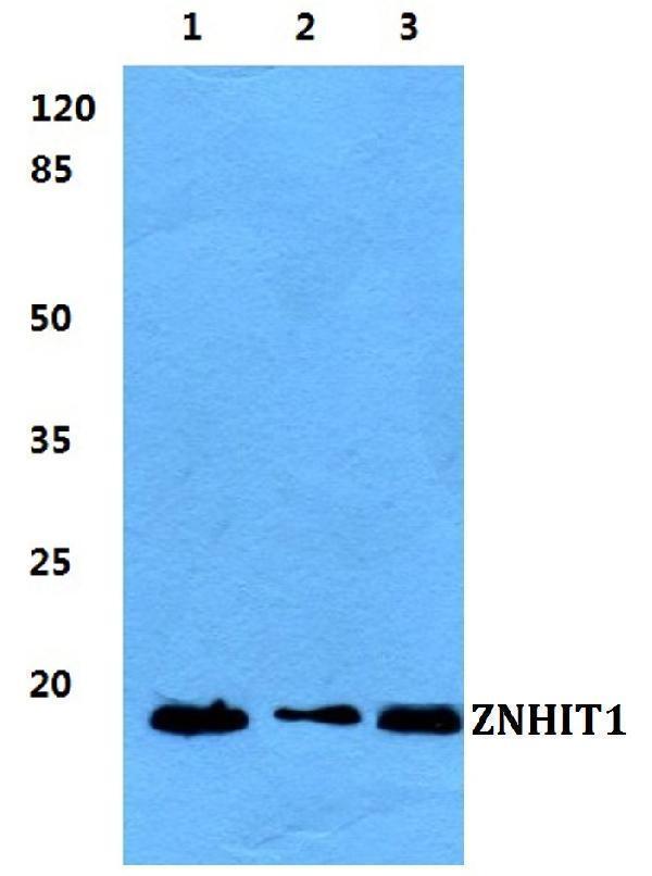 a12010 1 znhit1 primary antiboties wb testing 1