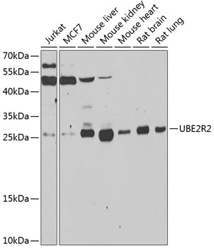 a12011 ube2r2 primary antiboties wb testing 1