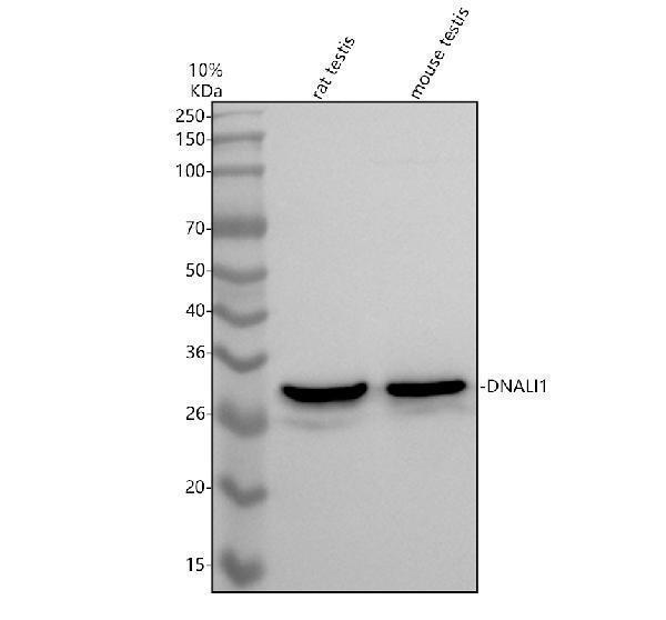 Western blot analysis of DNALI1 using anti-DNALI1 antibody (A12015)