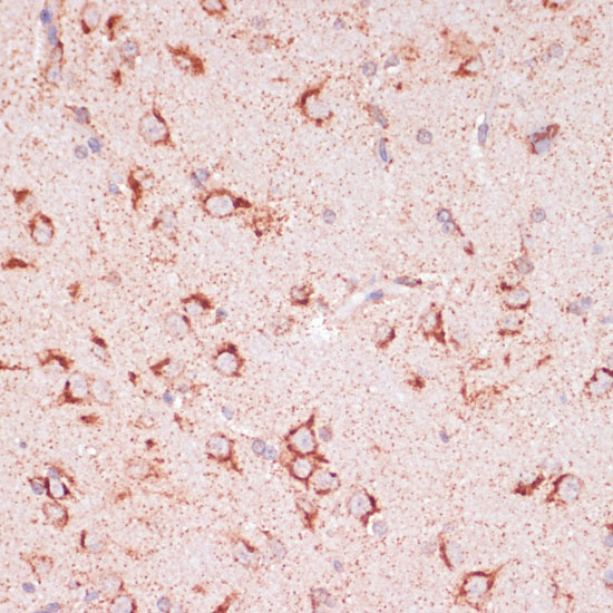 Immunohistochemistry of paraffin-embedded rat brain using ENTPD6 antibody  at dilution of 1:100 