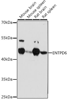 Western blot analysis of extracts of various cell lines, using ENTPD6 antibody  at 1:1000 dilution