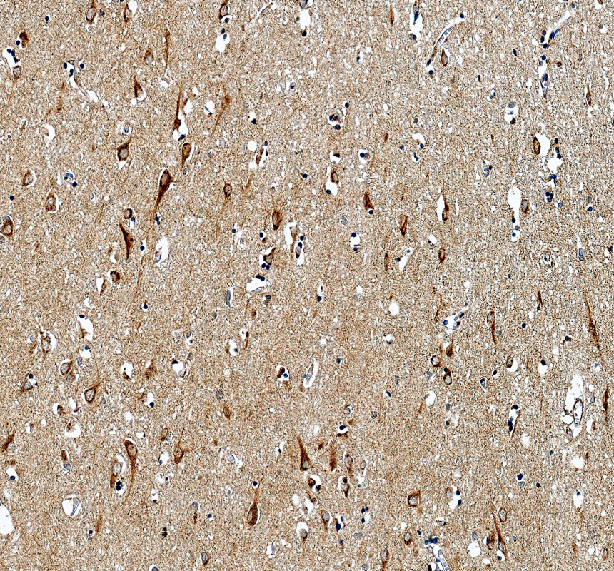 IHC analysis of NPTX1 using anti-NPTX1 antibody (A12018-2)