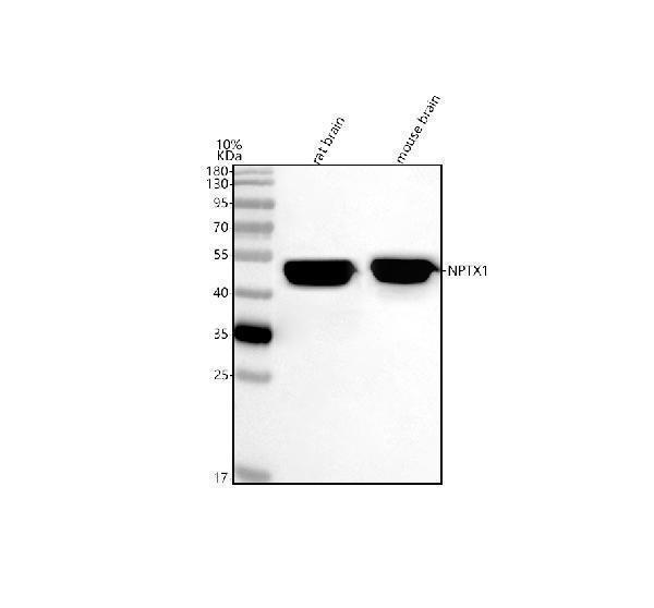  Western blot analysis of NPTX1 using anti-NPTX1 antibody (A12018-2)