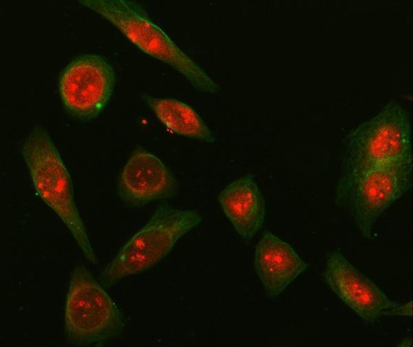 a12026 1 snrpd2 primary antibodies if testing 13