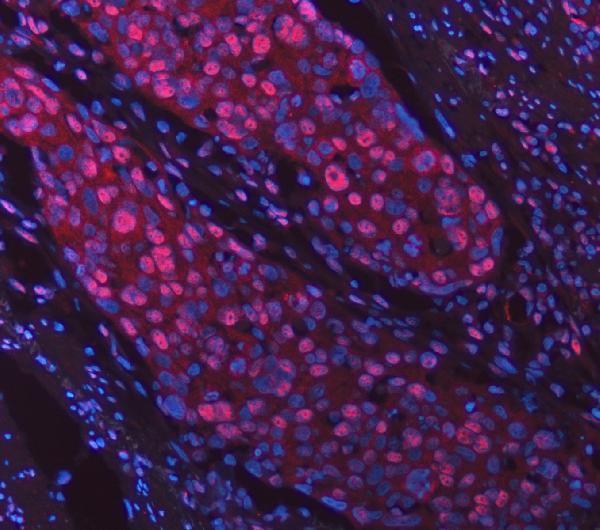 a12026 1 snrpd2 primary antibodies if testing 14
