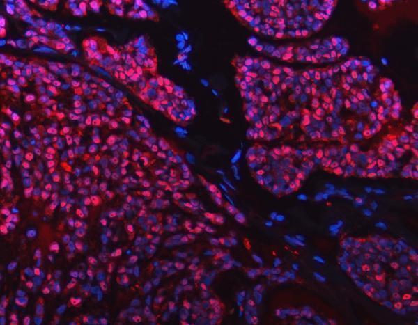 a12026 1 snrpd2 primary antibodies if testing 15