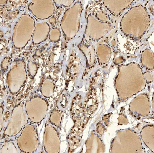 a12026 1 snrpd2 primary antibodies ihc testing 11