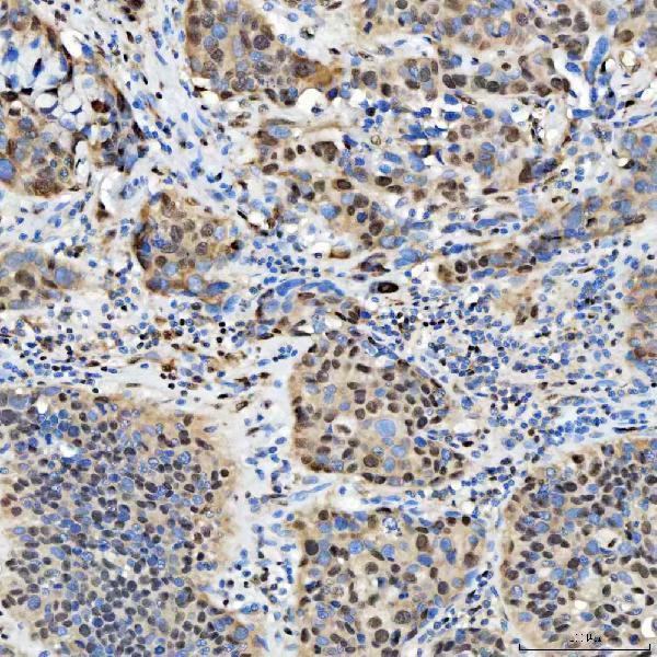 a12026 1 snrpd2 primary antibodies ihc testing 12