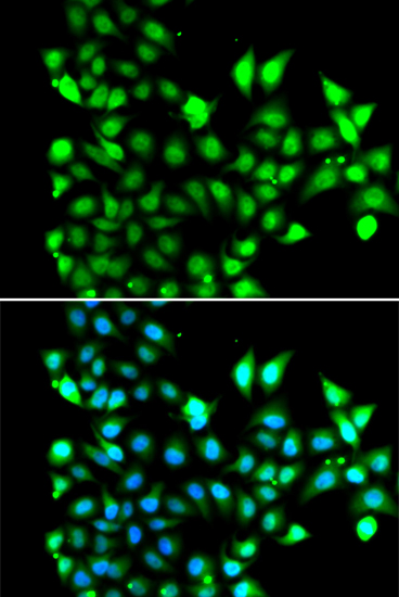 a12026 snrpd2 primary antiboties if testing 2