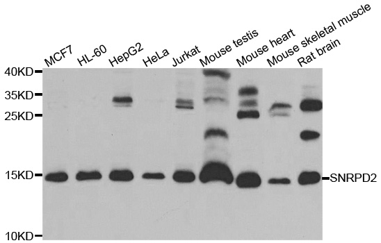 a12026 snrpd2 primary antiboties wb testing 1