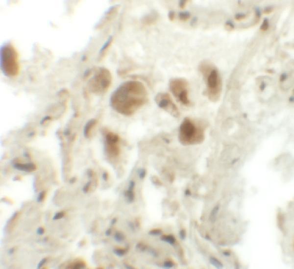 a12028 rassf10 primary antibodies ihc testing 2
