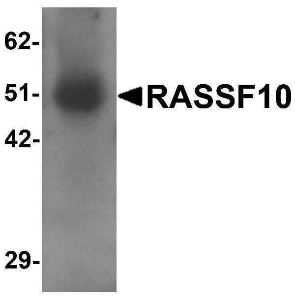 a12028 rassf10 primary antibodies wb testing 1