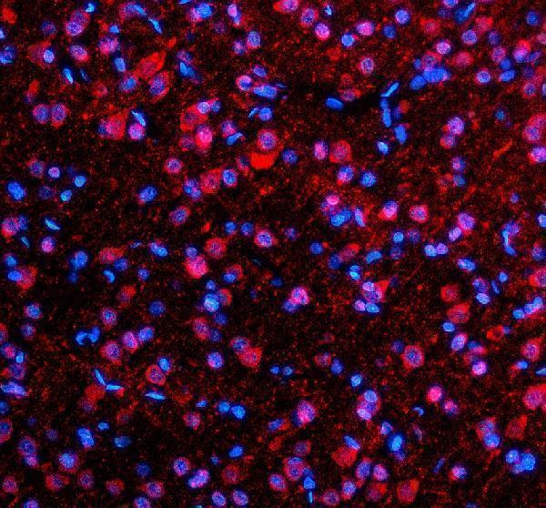 a12029 2 sfxn4 primary antibodies if testing 1