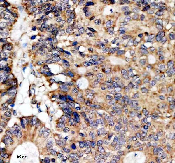 IHC analysis of SFXN4 using anti-SFXN4 antibody (A12029-2)