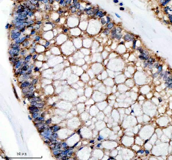 IHC analysis of SFXN4 using anti-SFXN4 antibody (A12029-2)