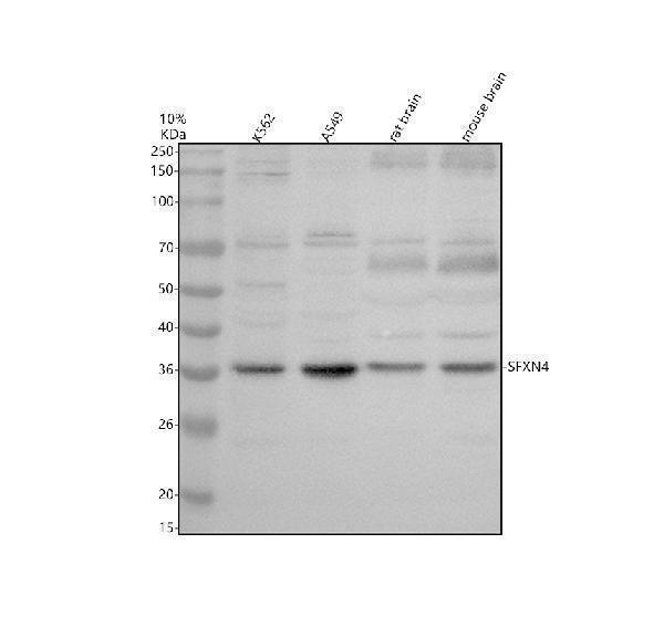 Western blot analysis of SFXN4 using anti-SFXN4 antibody (A12029-2)
