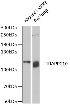 a12033 trappc10 primary antiboties wb testing 1