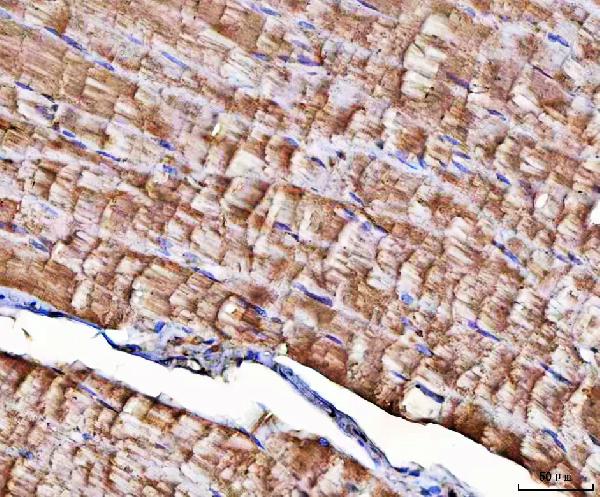 Figure 2. IHC analysis of NT5C1A using anti-NT5C1A antibody (A12036-2). NT5C1A was detected in a paraffin-embedded section of human skeletal muscle tissue. Heat mediated antigen retrieval was performed in EDTA buffer (pH 8.0, epitope retrieval solution). The tissue section was blocked with 10% goat serum. The tissue section was then incubated with 2 microg/ml rabbit anti-NT5C1A Antibody (A12036-2) overnight at 4°C. Peroxidase Conjugated Goat Anti-rabbit IgG was used as secondary antibody and incubated for 30 minutes at 37°C. The tissue section was developed using HRP Conjugated Rabbit IgG Super Vision Assay Kit (Catalog # SV0002) with DAB as the chromogen.