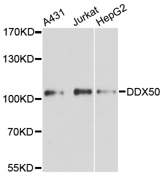 a12041 ddx50 primary antiboties wb testing 1
