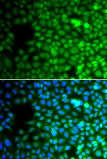 a12046 znf195 primary antiboties if testing 2