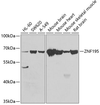 a12046 znf195 primary antiboties wb testing 1