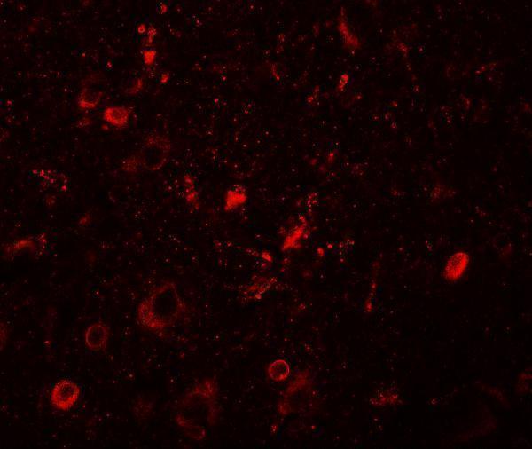a12048 sgsm1 primary antibodies if testing 2