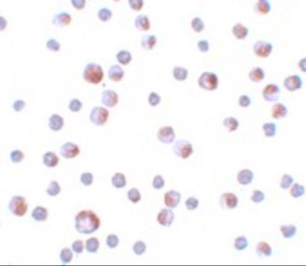 Immunocytochemistry of TCTN3 in HeLa cells with TCTN3 antibody at 4 μg/mL