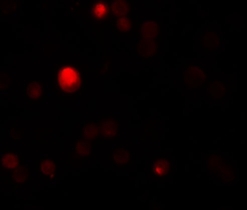 Immunofluorescence of TCTN3 in HeLa cells with TCTN3 antibody at 20 μg/mL