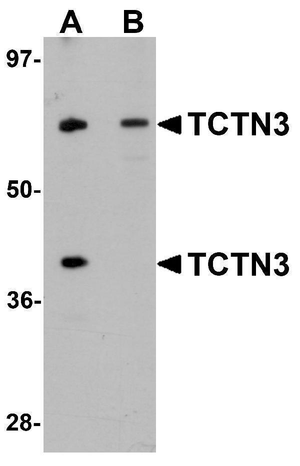 Western blot analysis of TCTN3 in HeLa cell lysate with TCTN3 antibody at (A) 1 and (B) 2μg/mL